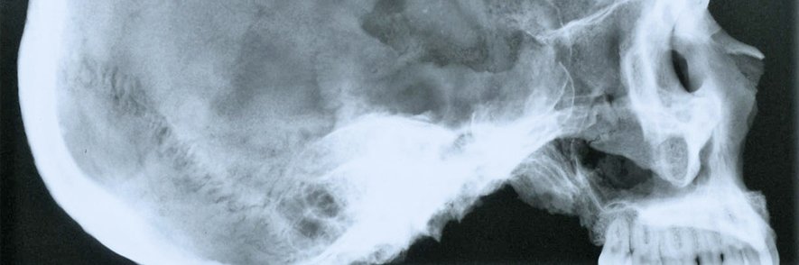 Röntgenbild eines Schädels