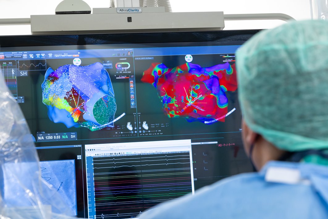 Bildschirm mit Herzdarstellung in 3D davor ein Mann von hinten mit medizinischer Schutzkleidung