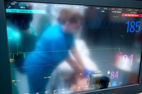 Man sieht die dunkle und matte Oberfläche eines Monitors, der Vitaldaten eines Patienten darstellt. In der Spiegelung des Monitors ist unscharf eine Person zu erkennen, die in blauen medizinischem Arbeitsschutz gekleidet an einem Patienten arbeitet.