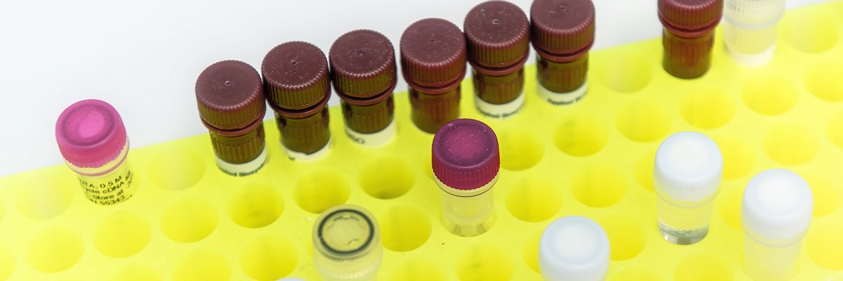 Laborständer in gelb mit Reagenzgläsern mit roten Deckeln